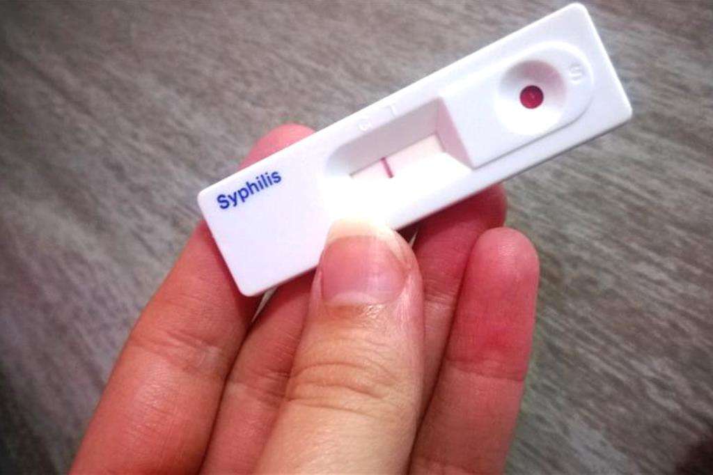 sifilis