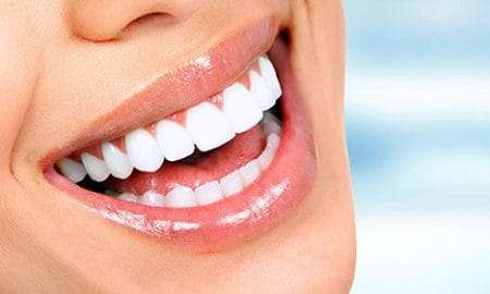 clareamento dentario