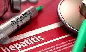 hepatite