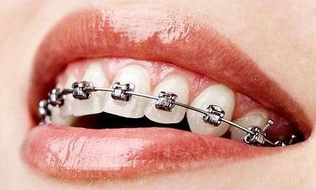 ortodontia unesc