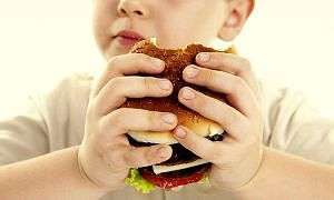 obesidade infantil unesc