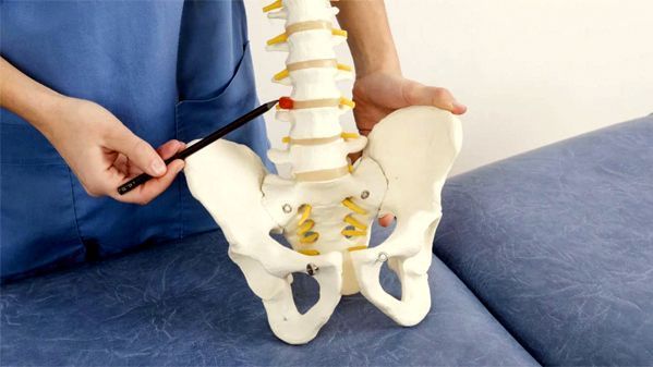 hérnia de disco