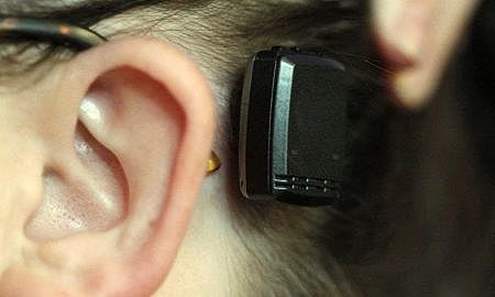 Foto ilustrativa do implante