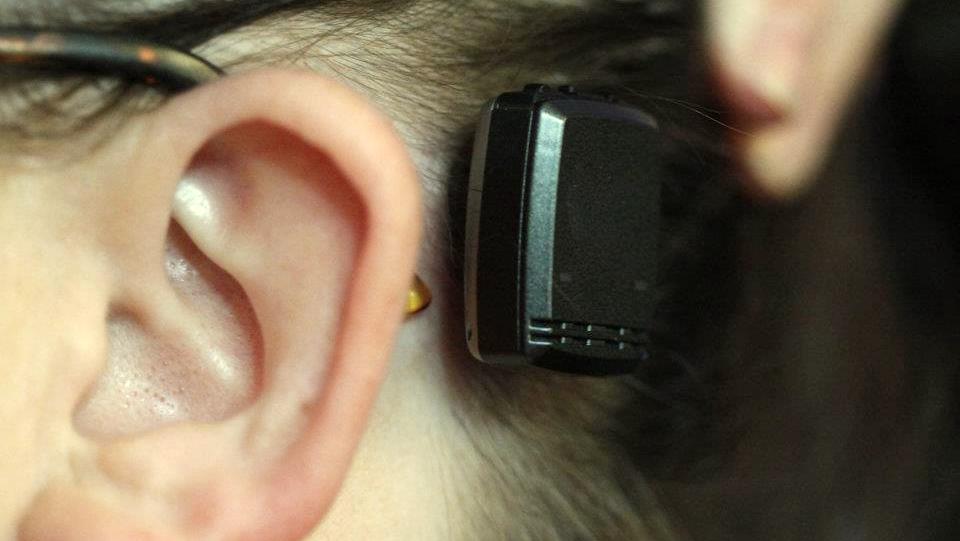 Foto ilustrativa do implante