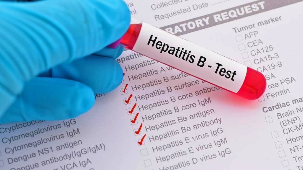 hepatite B 1
