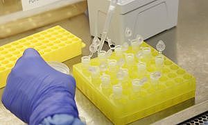 diagnostico laboratorial de casos suspeitos do novo coronavirus 2801209410