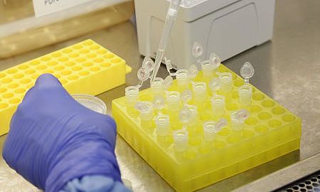 diagnostico laboratorial de casos suspeitos do novo coronavirus 2801209410