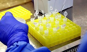 Coronavírus Josué Damacena