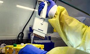 Testes Coronavírus Lacen Covid 19