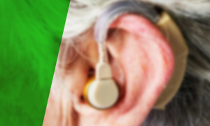 aparelho auditivo otoclinic 3