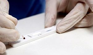 Teste Coronavírus Covid