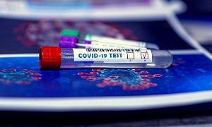 Coronavírus Covid 1