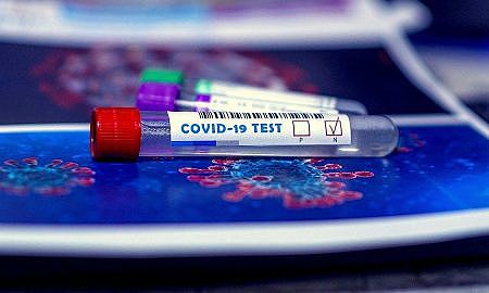 Coronavírus Covid 1