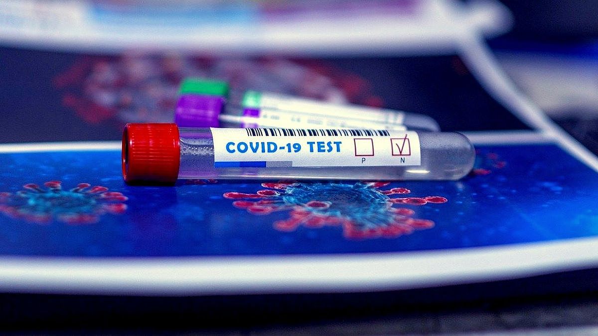 Coronavírus Covid 1