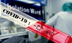 Coronavírus Covid 19 2