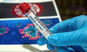 Coronavírus Covid 2