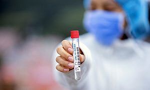 Coronavírus Covid 3