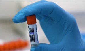 lacen 20210111 1236950345