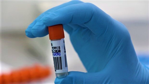 lacen 20210111 1236950345