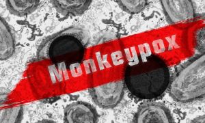 Mpox Varíola dos Macacos Contingência Monkeypox