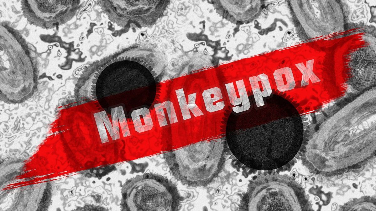 Varíola dos Macacos Contingência Monkeypox
