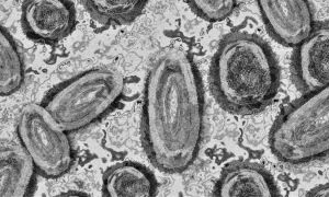 Varíola dos macacos prevenção Anvisa